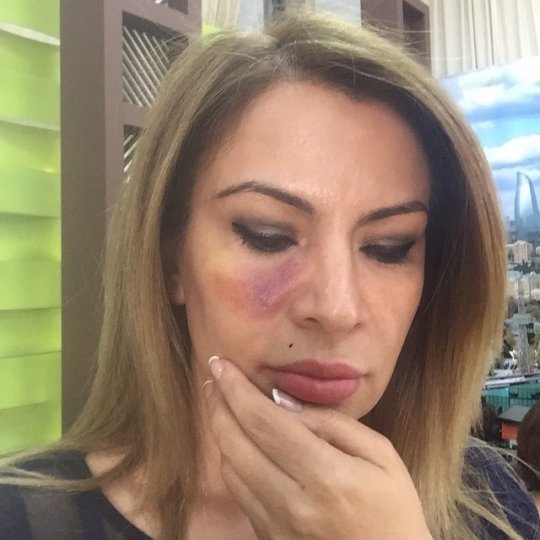 Aparıcı Ülvira Qarayeva döyüldümü? - FOTO FAKT
