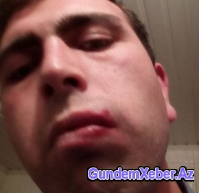 Şok: Sarkisyanın anasını söyən erməni müxalifətçinin "qulağı kəsildi" - Video Foto