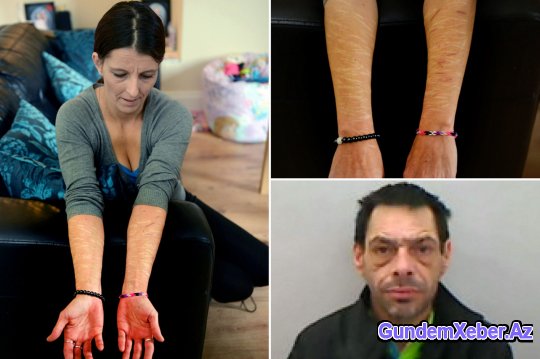 “Ərim məni iti ilə cinsi əlaqəyə məcbur edirdi” – FOTO - ŞOK TƏFƏRRÜAT