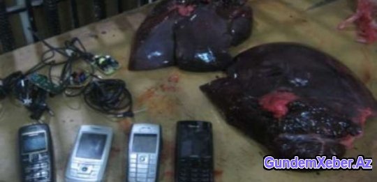 Ciyərdən 4 telefon çıxdı - BAKIDA