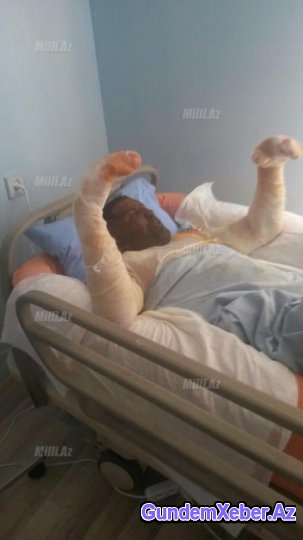 Azərbaycanda bir qığılcımla həyatdan silinən gənc ailə - FOTOLAR (18+)
