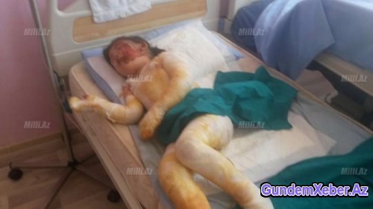 Azərbaycanda bir qığılcımla həyatdan silinən gənc ailə - FOTOLAR (18+)