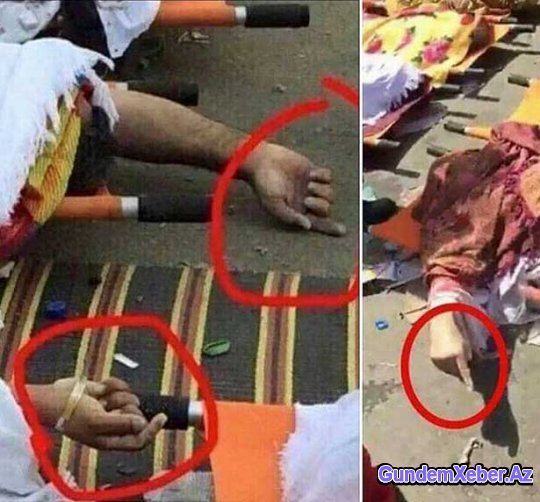 Həccdə həlak olanların barmaqları nəyə işarə edir? (Fotolar)