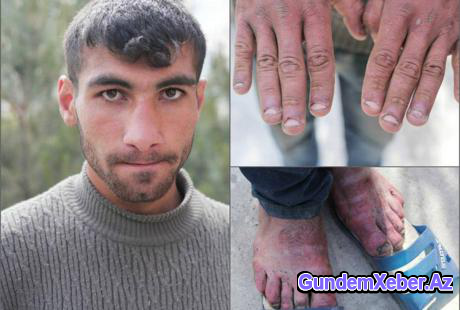 Bakıdakı dəhşətli faciədə yanan ''xilaskar'' əllərə qandal vuruldu - FOTO