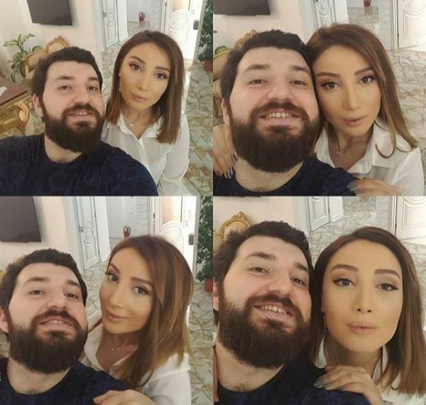 Bu da Günayın yeni burnu