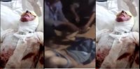 Azərbaycanlı gəlinin üzünə "kislota" tökdülər, dayısını isə soyundurub... +18 VİDEO+FOTO (ÖZƏL)