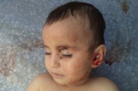 Zəhranın ölümü ilə əlaqədar səfirliklərin qarşısına təyin olunmuş yürüş təxirə salınıb