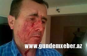 Məhbub Zülfüqarlı kəsişən maraqların qurbanı oldu