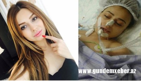 Ölən modelin anası: "Qızımı əməliyyata gözündə linza, saçında qaynaqla salmışdılar" - FOTO