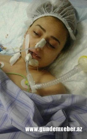 Ölən modelin anası: "Qızımı əməliyyata gözündə linza, saçında qaynaqla salmışdılar" - FOTO