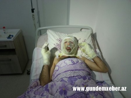 Yol polisi ilə dalaşıb özünü yandıran sürücünün GÖRÜNTÜLƏRİ - TƏFƏRRÜAT (Video+Foto)