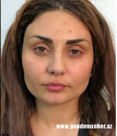 Şəbnəm Tovuzlunun elə bir fotosu internetə sızdı ki, hər yerdə onu sildirir- FOTO