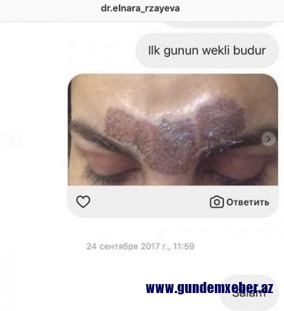 Elnarə Rzayevanın pis günə qoyduğu daha bir müştərisi - Fotolar