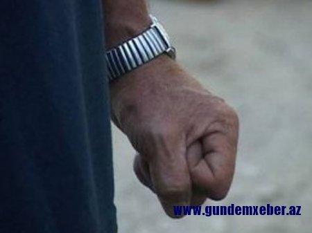 Tovuzda toyda dava: 48 yaşlı kişini döyüb dişlərini qırdılar