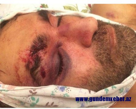 Qazax rayon sakini polisdə işgəncə verilərək öldürülüb - VİDEO
