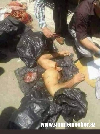 ​ŞOK: Kamal Qaşıqçını tikə-tikə doğrayıb,üzünün dərisini soydular - 18+ FOTOLAR (ÜRƏYİ ZƏİF OLANLAR BAXMASIN)