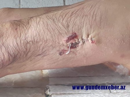 Yasamaldakı “tükürpədici ölüm” faktının gizlinləri-FOTO-VİDEO