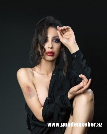 ​Qazaxıstanda açıq-saçıq geyinən millət vəkilini döydülər - FOTO  