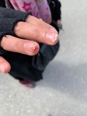 MİLLİ MƏCLİSİN ÜZVÜ ADİL ƏLİYEVƏ VƏ ONUN “MEDAL”INA CAVAB!