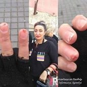 MİLLİ MƏCLİSİN ÜZVÜ ADİL ƏLİYEVƏ VƏ ONUN “MEDAL”INA CAVAB!