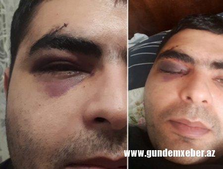 ATA "BEŞBARMAQ" ZƏRBƏSİ ALAN OĞLUNUN TALEYİNDƏN NARAHATDIR