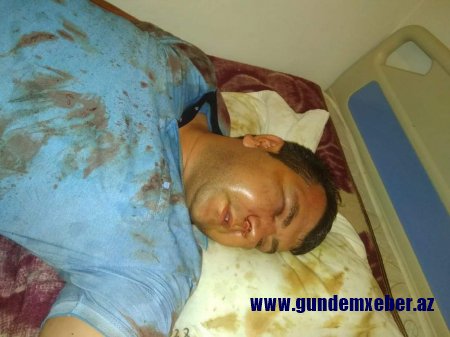 Vətəndaşın ölümcül döyülməsinə görə, DIN kriminal dəstənin qarşısında niyə susur?-ŞOK OLAY 
