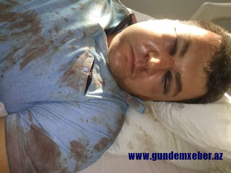 Vətəndaşın ölümcül döyülməsinə görə, DIN kriminal dəstənin qarşısında niyə susur?-ŞOK OLAY 