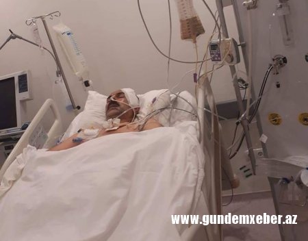 Oqtay Gülalıyevi süni nəfəs aparatından ayırdılar – SON XƏBƏR (Foto)