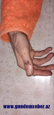 "Qardaşım polislərin verdiyi işgəncədən dünyasını dəyişdi..." - Müəmmalı ölümlə bağlı sensasion iddia	 (FOTOLAR)