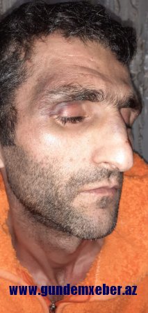 "Qardaşım polislərin verdiyi işgəncədən dünyasını dəyişdi..." - Müəmmalı ölümlə bağlı sensasion iddia	 (FOTOLAR)
