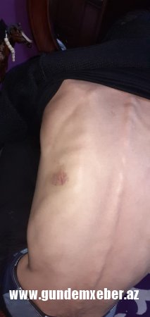 "Qardaşım polislərin verdiyi işgəncədən dünyasını dəyişdi..." - Müəmmalı ölümlə bağlı sensasion iddia	 (FOTOLAR)
