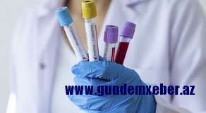 Bakıda koronavirus tədbirləri: Məscid, məktəb, sinaqoq… – Rəsmi
