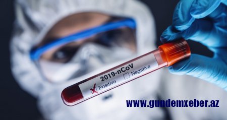  Azərbaycanda daha 61 nəfərdə koronavirus aşkarlanıb - karantində 4 518 nəfər var