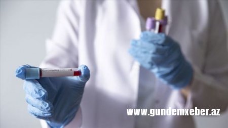 Azərbaycanda daha 49 nəfərdə koronavirus aşkarlandı - 1 nəfər vəfat etdi