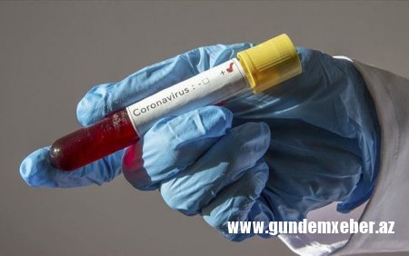 Daha 262 nəfər koronavirusa yoluxdu - 2 nəfər öldü