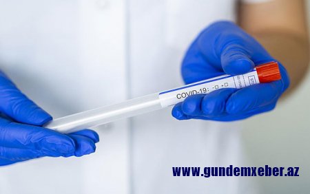 Daha 338 nəfərdə koronavirus aşkarlandı - 4 pasiyent vəfat etdi