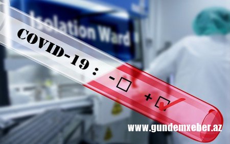 Daha 438 nəfərdə koronavirus aşkarlandı - 4 nəfər vəfat etdi