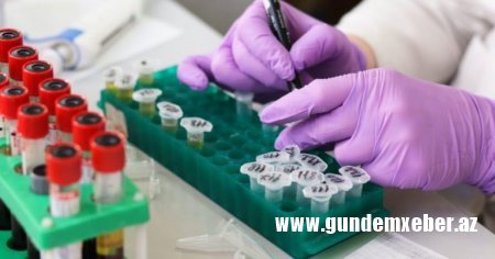  “Test müayinələri üçün niyə yalnız 3 özəl klinikaya icazə verilib?” – Ekspertdən AKTUAL SUAL