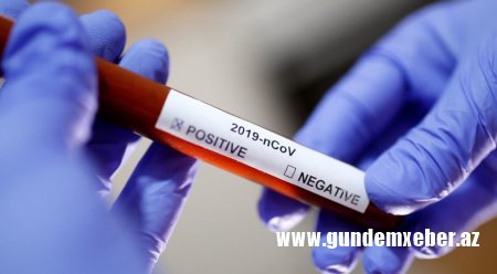 Azərbaycanda daha 497 nəfər koronavirusa yoluxub, 645 nəfər sağalıb