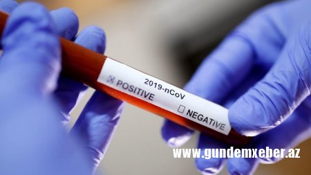 Daha 347 nəfərdə koronavirus aşkarlandı, 531 nəfər sağaldı
