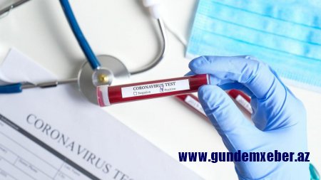 Ukraynda koronavirusa yoluxanların sayı 75 minə yaxınlaşır