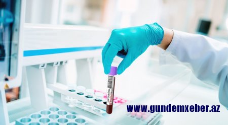 Azərbaycanda daha 152 nəfər COVID-19-a yoluxdu, 111 nəfər sağaldı