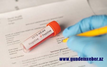 Azərbaycanda sutka ərzində 2 735 yeni yoluxma faktı qeydə alınıb