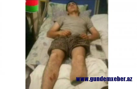 Qazaxın icra başçısından Vətən müharibəsi qazisinə sayğısızlıq — FOTO