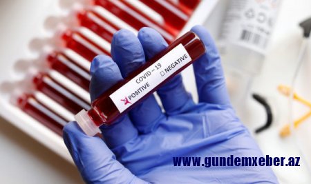 Evi tərk edən 29 aktiv koronavirus xəstəsi müəyyən edilərək saxlanıldı