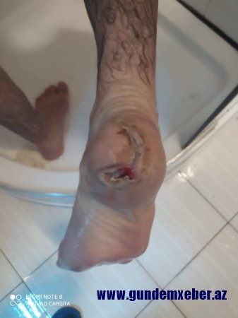 Naftalan İcra Hakimiyyətindən Qarabağ qazisinə "ticarət" təklifi - İLGİNC FAKTLAR - VİDEO/FOTO