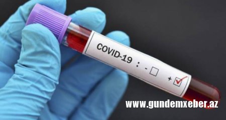 Azərbaycanda son sutkada 2091 nəfər COVID-19-dan sağalıb, 963 nəfər yoluxub - 17 nəfər vəfat edib