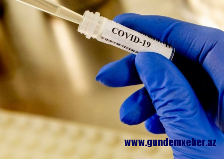 Dünyada COVID-19-dan ölənlərin sayı 4 milyonu keçdi