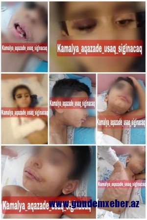 Azərbaycanda DƏHŞƏT: Ana və sevgilisi beş yaşlı uşağın dilini qopardı - FOTO