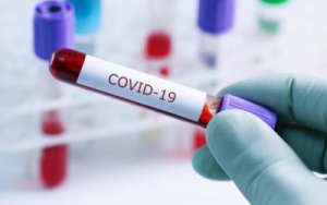 Rusiyada COVID-19-dan ölənlərin sayı 328 mini ötüb